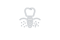 Implant Placement