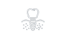 Implant Placement